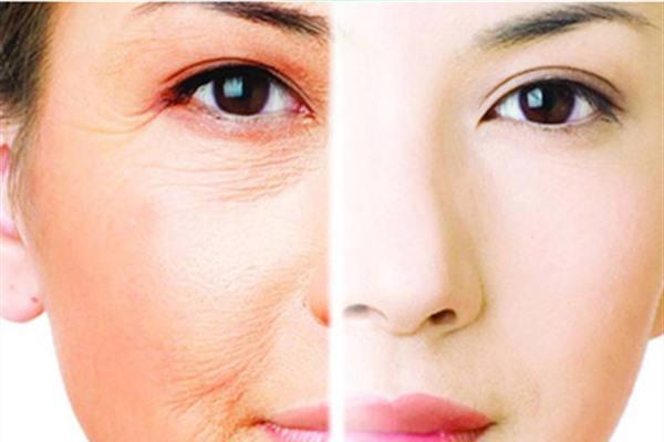 做<a href=http://m.f3bb6.cn/listinfo-734-0.html target=_blank class=infotextkey>愛貝芙</a><a href=http://m.f3bb6.cn/listinfo-614-0.html target=_blank class=infotextkey>除皺</a>效果好不好