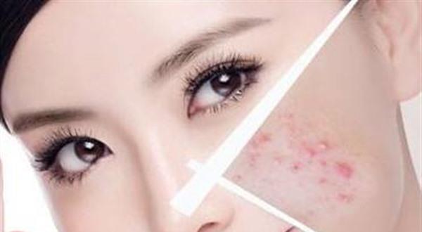 做<a href=http://m.f3bb6.cn/listinfo-613-0.html target=_blank class=infotextkey>射頻</a><a href=http://m.f3bb6.cn/listinfo-768-0.html target=_blank class=infotextkey>微針</a><a href=http://m.f3bb6.cn/listinfo-797-0.html target=_blank class=infotextkey>去痘疤</a>費用要多少