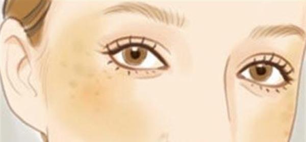做<a href=http://m.f3bb6.cn/listinfo-786-0.html target=_blank class=infotextkey>去黃褐斑</a>有哪些風(fēng)險