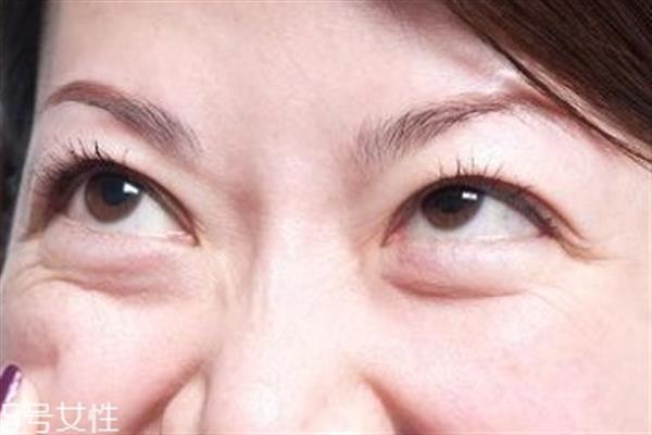 <a href=http://m.f3bb6.cn/listinfo-708-0.html target=_blank class=infotextkey>去眼袋</a>手術幾天拆線好 <a href=http://m.f3bb6.cn/listinfo-708-0.html target=_blank class=infotextkey>去眼袋</a>最永久的方法