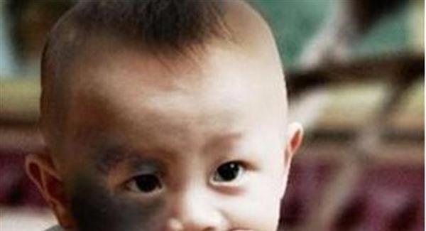 做激光<a href=http://m.f3bb6.cn/listinfo-799-0.html target=_blank class=infotextkey>去太田痣</a>要花多長時間