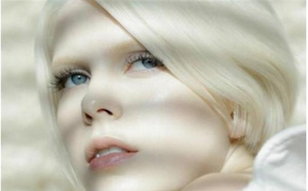 激光<a href=http://m.f3bb6.cn/listinfo-795-0.html target=_blank class=infotextkey>祛斑</a>對眼睛有傷害嗎