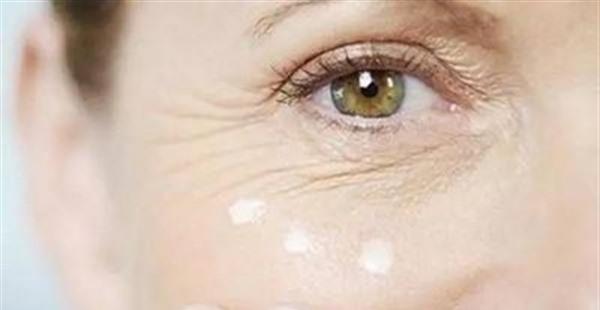 激光祛魚尾紋有哪些優(yōu)勢