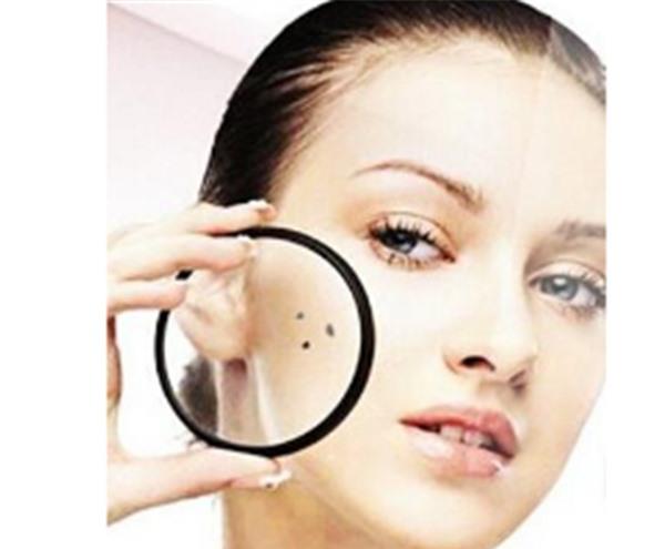 做微晶磨削點痣不適應人群有哪些