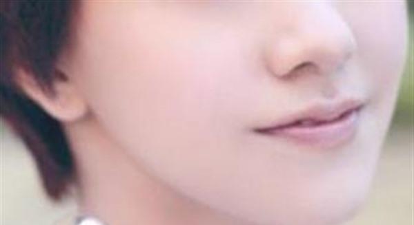 <a href=http://m.f3bb6.cn/listinfo-783-0.html target=_blank class=infotextkey>祛疤</a>的費用是多少