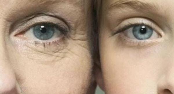 做<a href=http://m.f3bb6.cn/listinfo-780-0.html target=_blank class=infotextkey>去魚尾紋</a>副作用