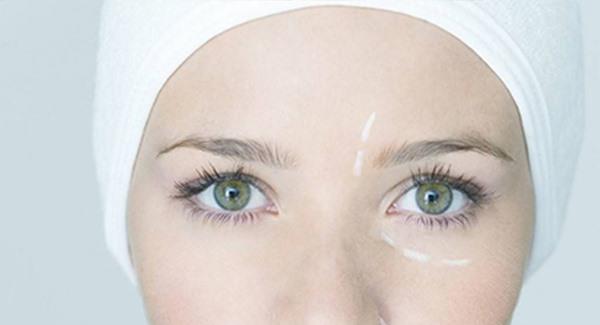 激光<a href=http://m.f3bb6.cn/listinfo-795-0.html target=_blank class=infotextkey>祛斑</a>三天后的照片