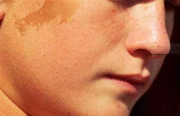 E光<a href=http://m.f3bb6.cn/listinfo-795-0.html target=_blank class=infotextkey>祛斑</a>效果好嗎