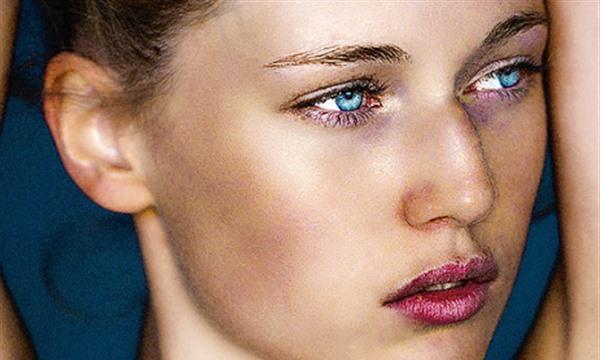 光子祛痘哪個比較好