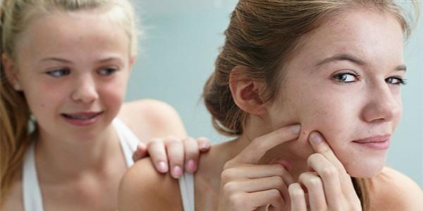 激光祛痘能維持多久