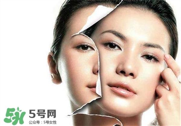 美白養護是什么？美白養護可以連續打嗎？