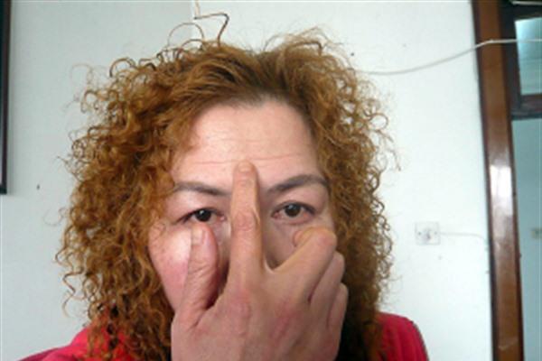 做<a href=http://m.f3bb6.cn/listinfo-765-0.html target=_blank class=infotextkey>去抬頭紋</a>失敗修復效果好不好