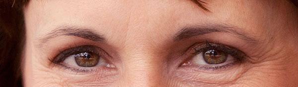 做膠原蛋白<a href=http://m.f3bb6.cn/listinfo-780-0.html target=_blank class=infotextkey>去魚尾紋</a>手術(shù)多少錢？