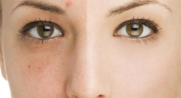 做<a href=http://m.f3bb6.cn/listinfo-613-0.html target=_blank class=infotextkey>射頻</a><a href=http://m.f3bb6.cn/listinfo-768-0.html target=_blank class=infotextkey>微針</a><a href=http://m.f3bb6.cn/listinfo-797-0.html target=_blank class=infotextkey>去痘疤</a>價格是多少