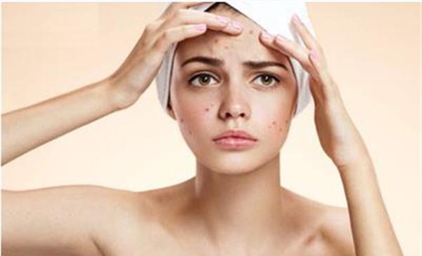 臉上長痘痘如何祛痘