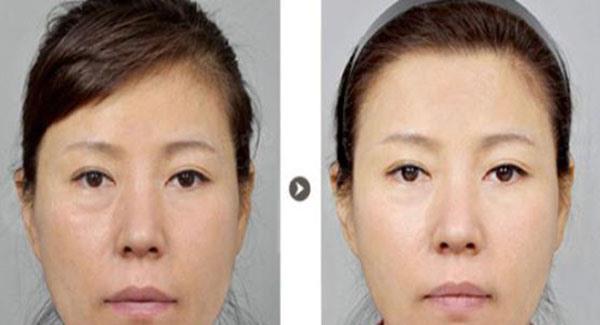 做彩光<a href=http://m.f3bb6.cn/listinfo-770-0.html target=_blank class=infotextkey>嫩膚</a>副作用