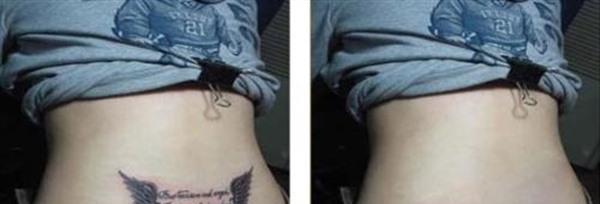 做激光<a href=http://m.f3bb6.cn/listinfo-793-0.html target=_blank class=infotextkey>洗紋身</a>價格要多少