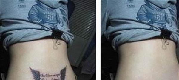 激光<a href=http://m.f3bb6.cn/listinfo-793-0.html target=_blank class=infotextkey>洗紋身</a>大概多少錢