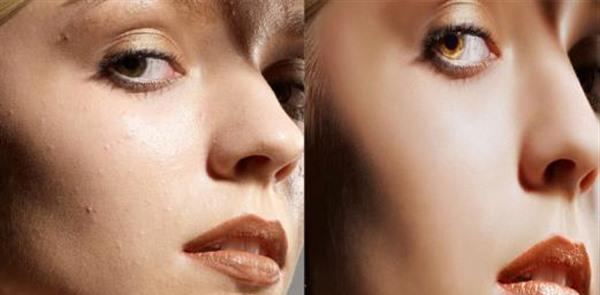 微晶磨皮<a href=http://m.f3bb6.cn/listinfo-782-0.html target=_blank class=infotextkey>去眼角細紋</a>治療方式是什么？