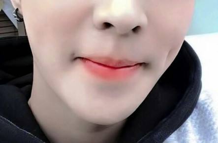 酒窩成形術(shù)哪種的時效較久