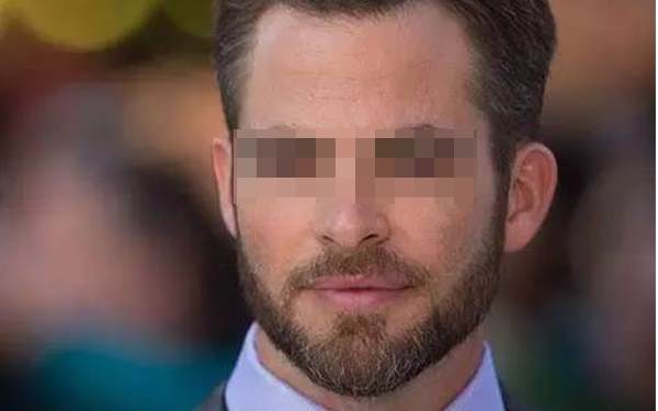 胡須種植術(shù)的成活率高嗎