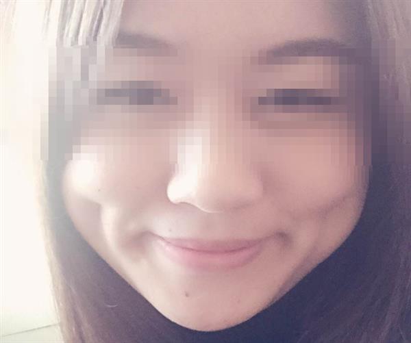 <a href=http://m.f3bb6.cn/listinfo-637-0.html target=_blank class=infotextkey>酒窩整形</a>多少錢及術后護理