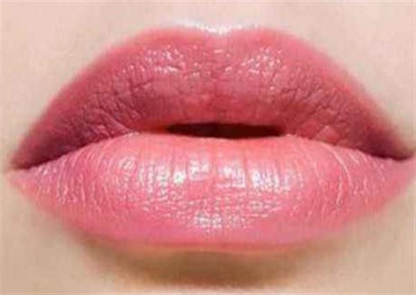 鵝口瘡多久才能好