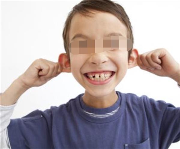 北京<a href=http://m.f3bb6.cn/listinfo-692-0.html target=_blank class=infotextkey>耳部整形</a>費(fèi)用