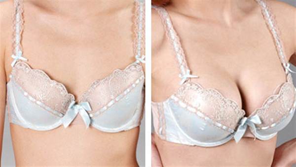 注射<a href=http://m.f3bb6.cn/listinfo-618-0.html target=_blank class=infotextkey>隆胸</a>術的價格