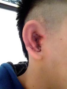 珠海全<a href=http://m.f3bb6.cn/listinfo-699-0.html target=_blank class=infotextkey>耳再造</a>修復的價格是多少