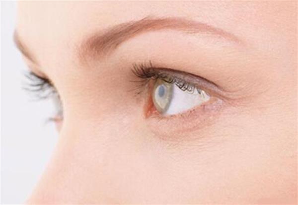 眼角如何祛皺