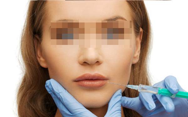 日照市激光去痣費用是多少