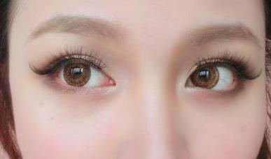 <a href=http://m.f3bb6.cn/listinfo-724-0.html target=_blank class=infotextkey>雙眼皮</a>埋線能管幾年