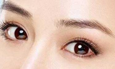 割<a href=http://m.f3bb6.cn/listinfo-724-0.html target=_blank class=infotextkey>雙眼皮</a>埋線多少錢