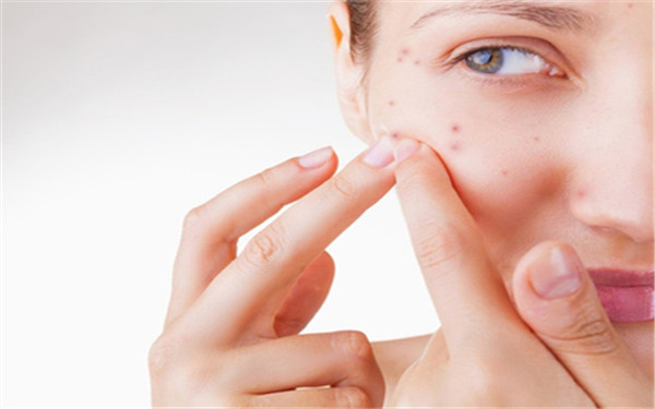 填一個痘坑需要多少錢