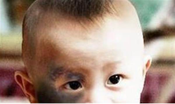 <a href=http://m.f3bb6.cn/listinfo-773-0.html target=_blank class=infotextkey>去胎記</a>大概多少錢