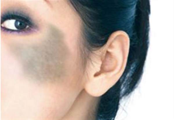 <a href=http://m.f3bb6.cn/listinfo-773-0.html target=_blank class=infotextkey>去胎記</a>價格