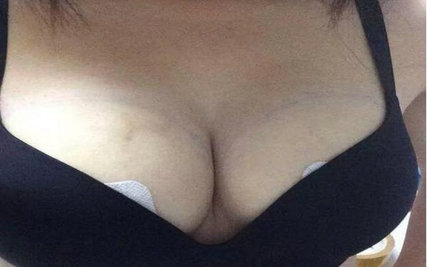 能注射<a href=http://m.f3bb6.cn/listinfo-618-0.html target=_blank class=infotextkey>隆胸</a>嗎?