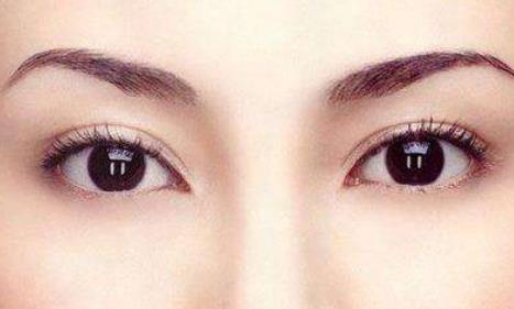 來月經能做<a href=http://m.f3bb6.cn/listinfo-724-0.html target=_blank class=infotextkey>雙眼皮</a>嗎