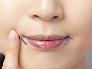 做一個嘴角上揚多少錢