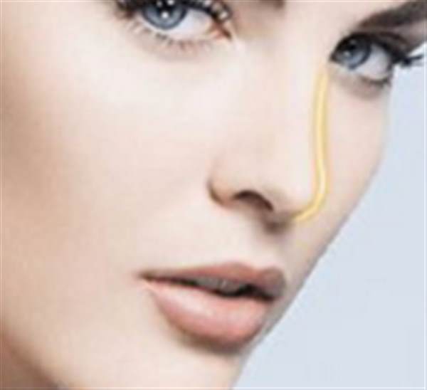 有什么<a href=http://m.f3bb6.cn/listinfo-757-0.html target=_blank class=infotextkey>鼻尖</a>矯正的方法?