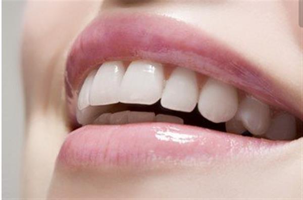 種植牙會不會很疼呢