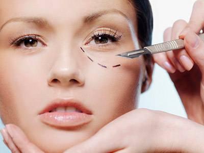 切眼袋后多久可以同房