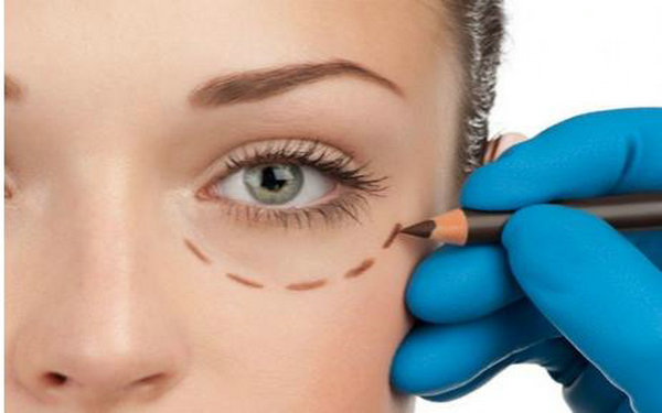 內(nèi)切祛眼袋有后遺癥么?