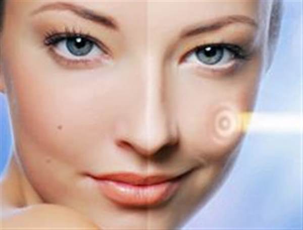 做像素激光的副作用有哪些