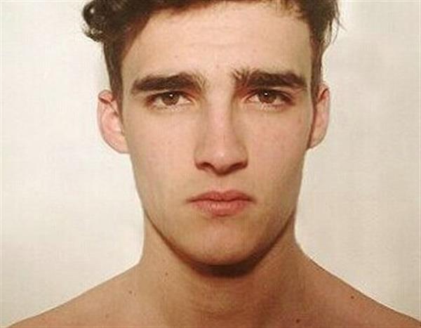 自體組織<a href=http://m.f3bb6.cn/listinfo-737-0.html target=_blank class=infotextkey>隆鼻</a>是怎樣的