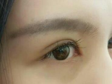 割<a href=http://m.f3bb6.cn/listinfo-724-0.html target=_blank class=infotextkey>雙眼皮</a>多久能長(zhǎng)自然