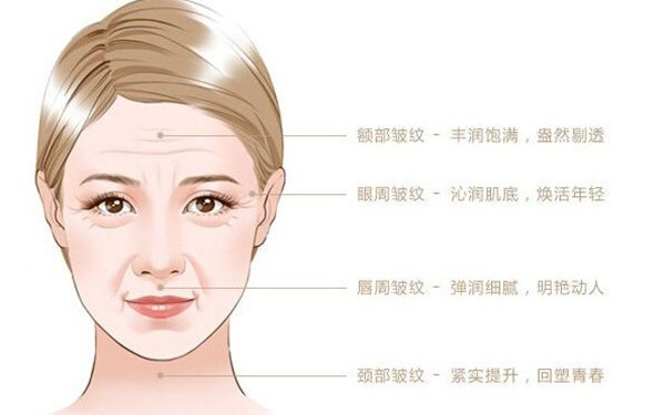 注射去皺針多少錢