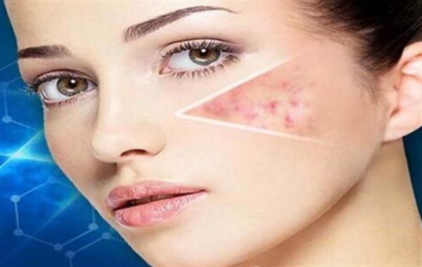 去除疤痕的好方法