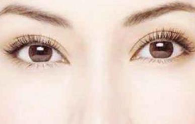 開<a href=http://m.f3bb6.cn/listinfo-724-0.html target=_blank class=infotextkey>雙眼皮</a>多久恢復(fù)